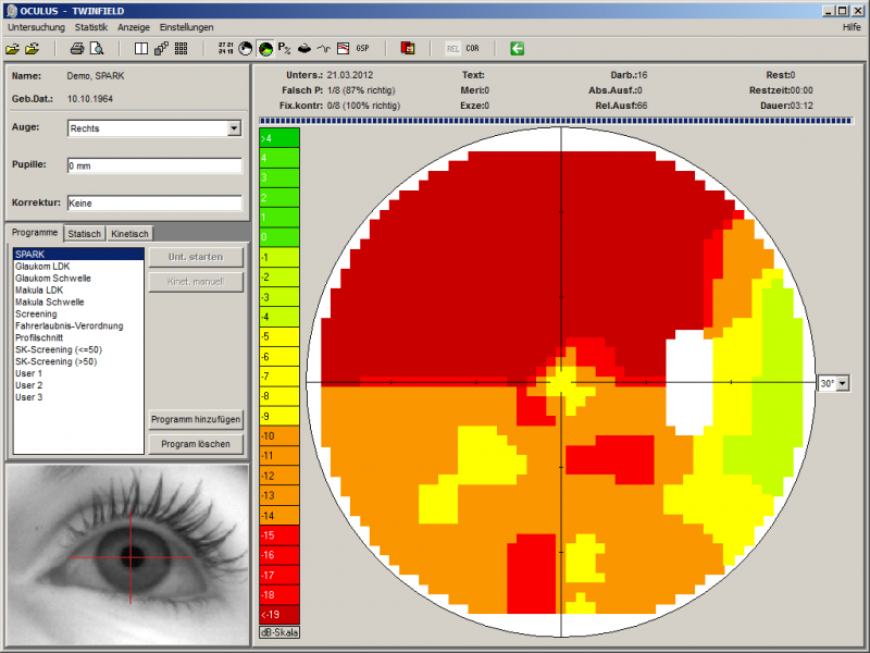 Screenshot der OCULUS Centerfield® 2 Software zur SPARK-Untersuchungsstrategie