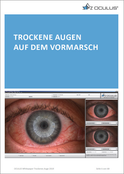 Cover für das Whitepaper "Trockene Augen auf dem Vormarsch"