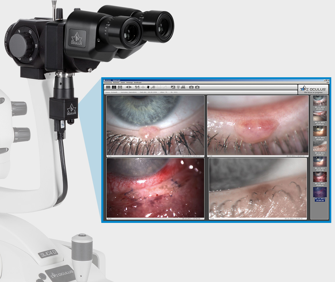 ImageCam3 an Spaltlampe SL-IC 4 D und Screenshot von Aufnahme am Auge
