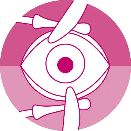 OCULUS LidStick® – Applications for Use: Debride OCULUS LidStick® – Applications for Use: Debride