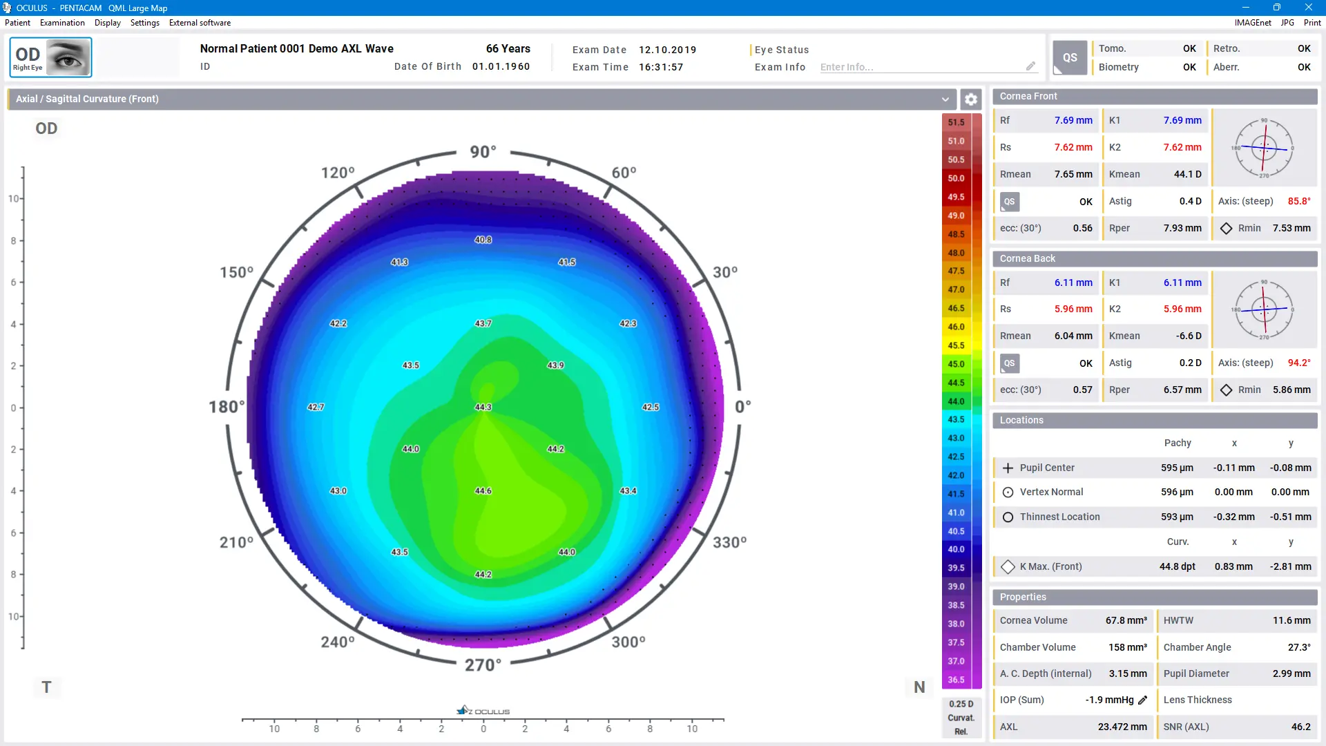 Pentacam® Software - 1 Large Color Map