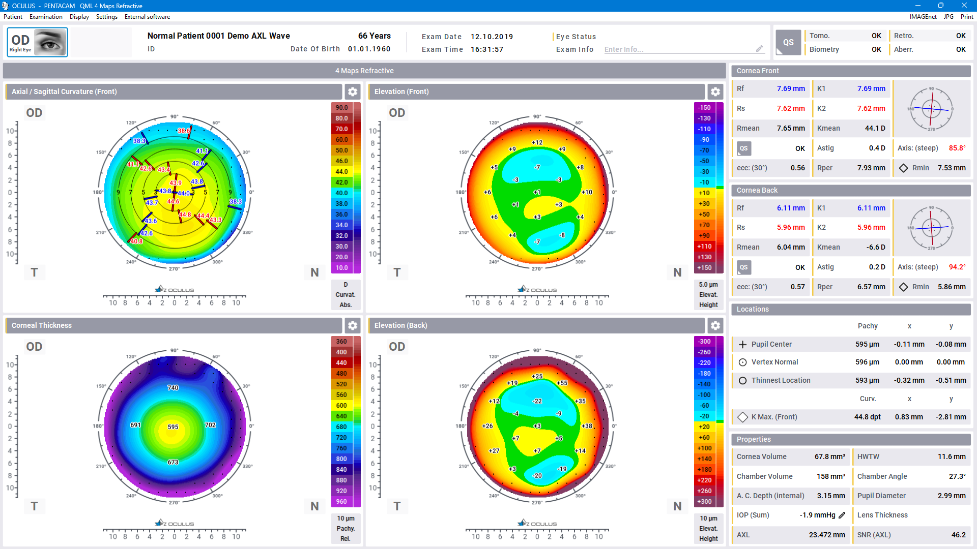Pentacam® Software - 4 Maps Refractive
