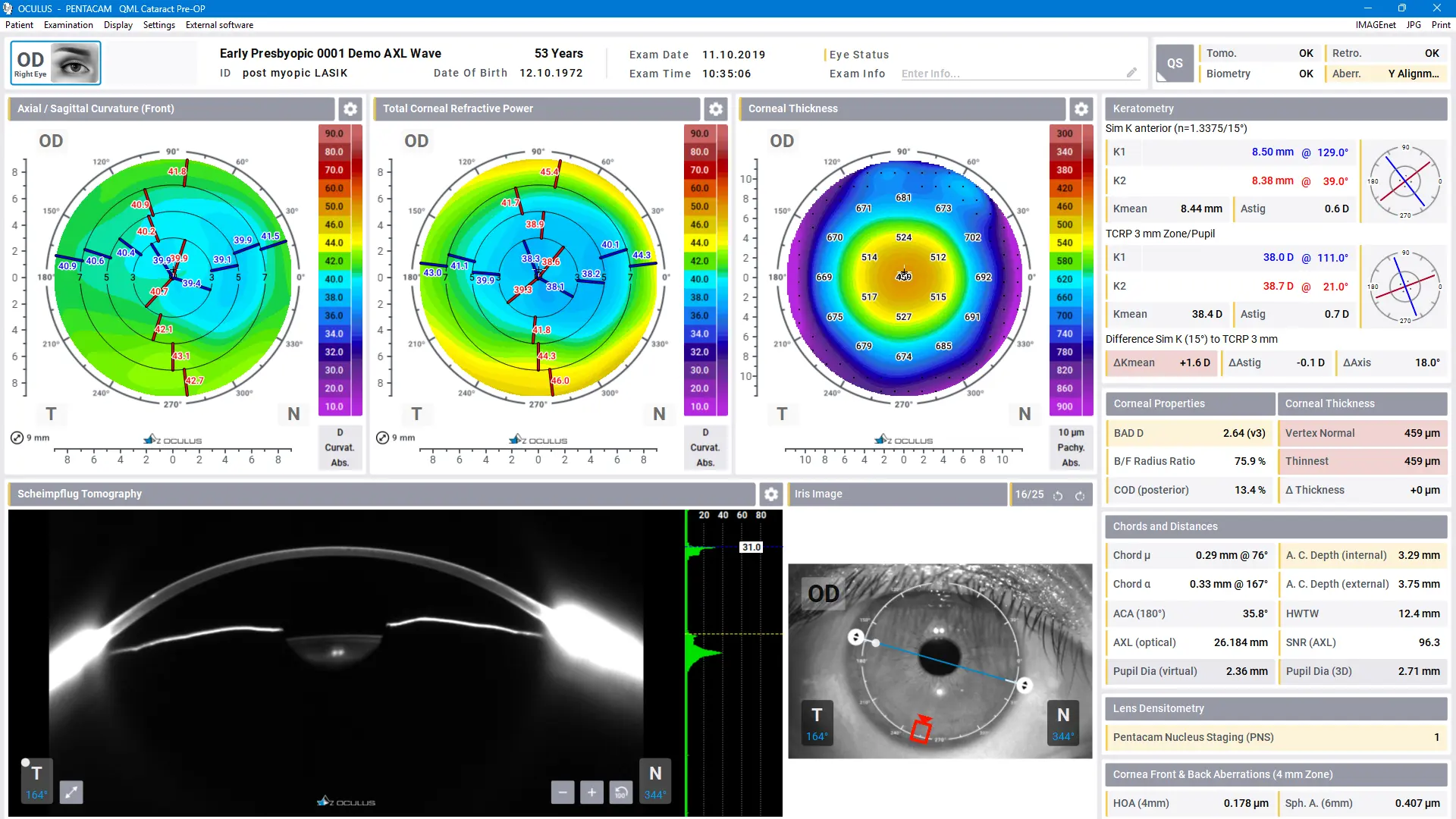Pentacam® Software - Cataract Pre-OP Display