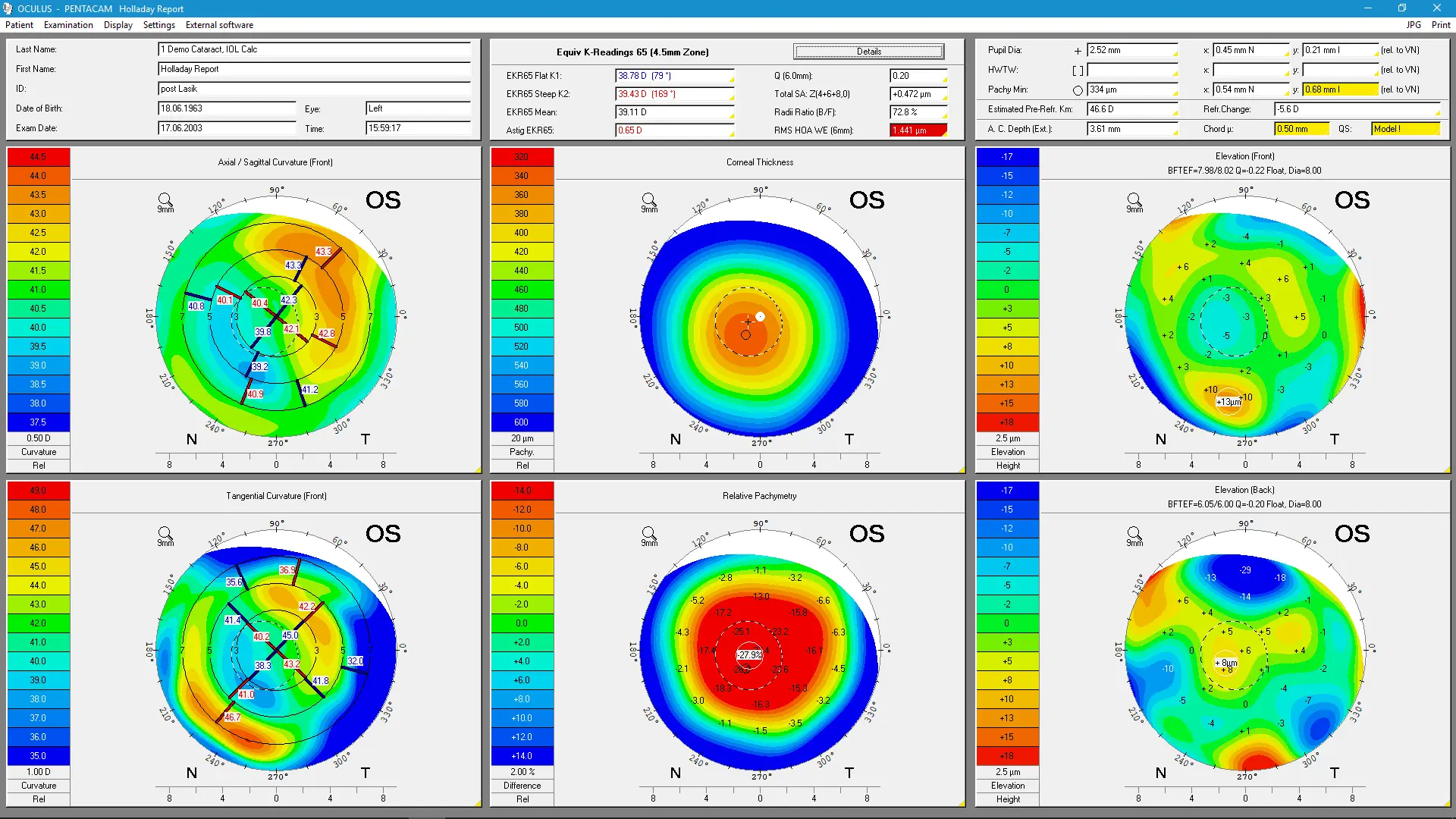 Pentacam® Software - Holladay Report / Holladay EKR Detail Report
