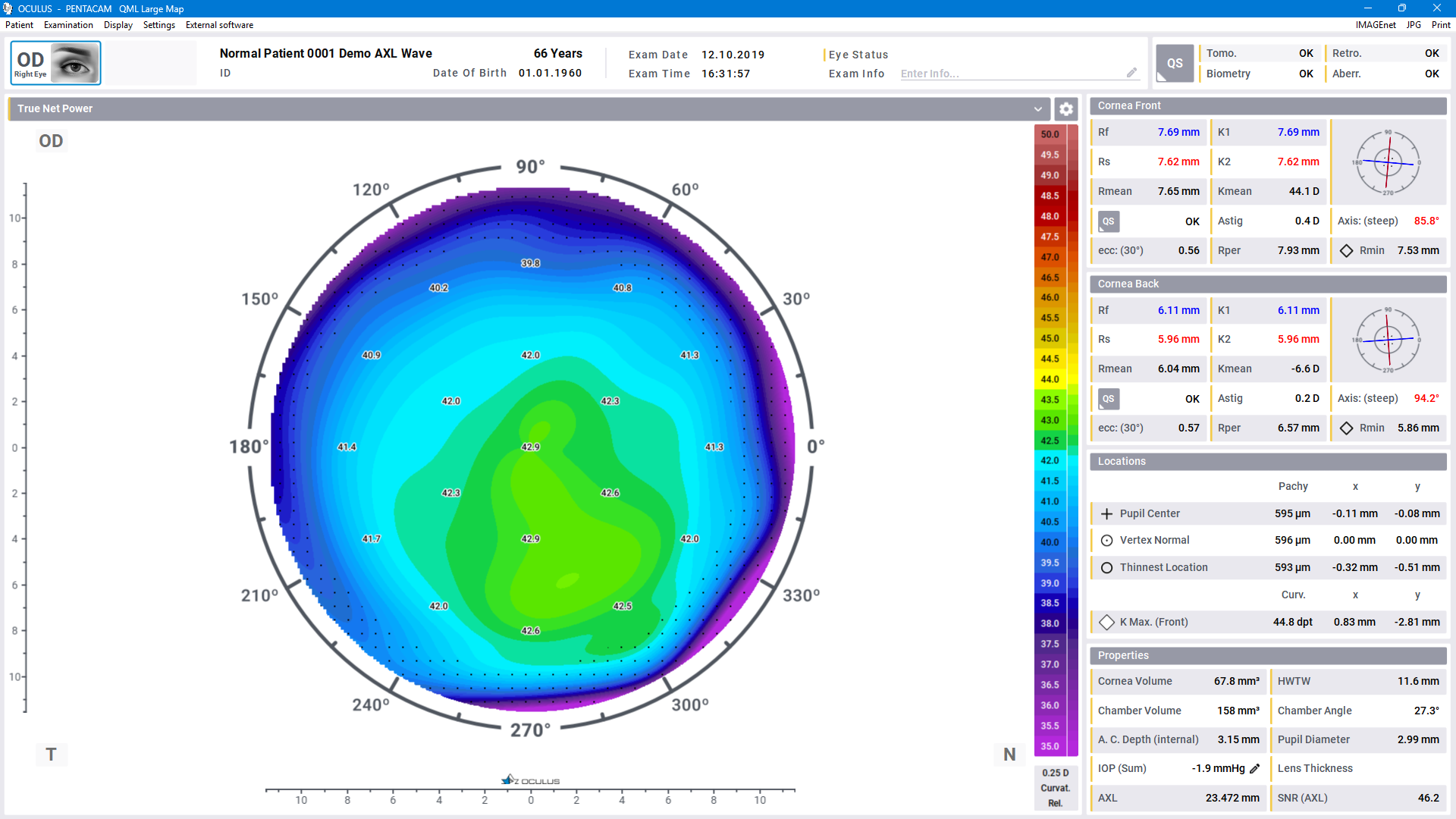 Pentacam® Software - True Net Power (TNP)