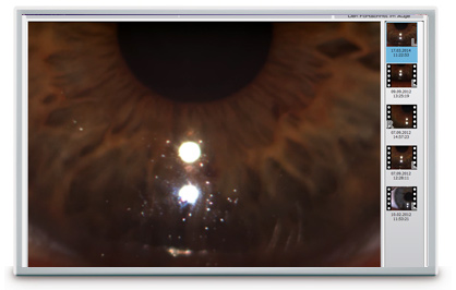 oculus k5m screenshot tfscan dynamik