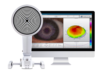 Keratograph® 5M - Topography & Contact Lens Fitting