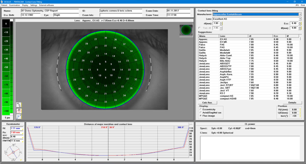 Barrett Rx Pentacam® Family | Applications - OCULUS, Inc.